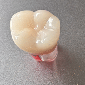 Endo teeth